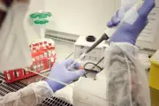 Remboursement tests cadmium : bénéficiaires et conditions