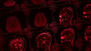 38 parasites dans le cerveau : son calvaire après un voyage en Inde